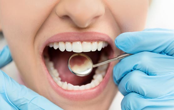 Dental exam and hygiene