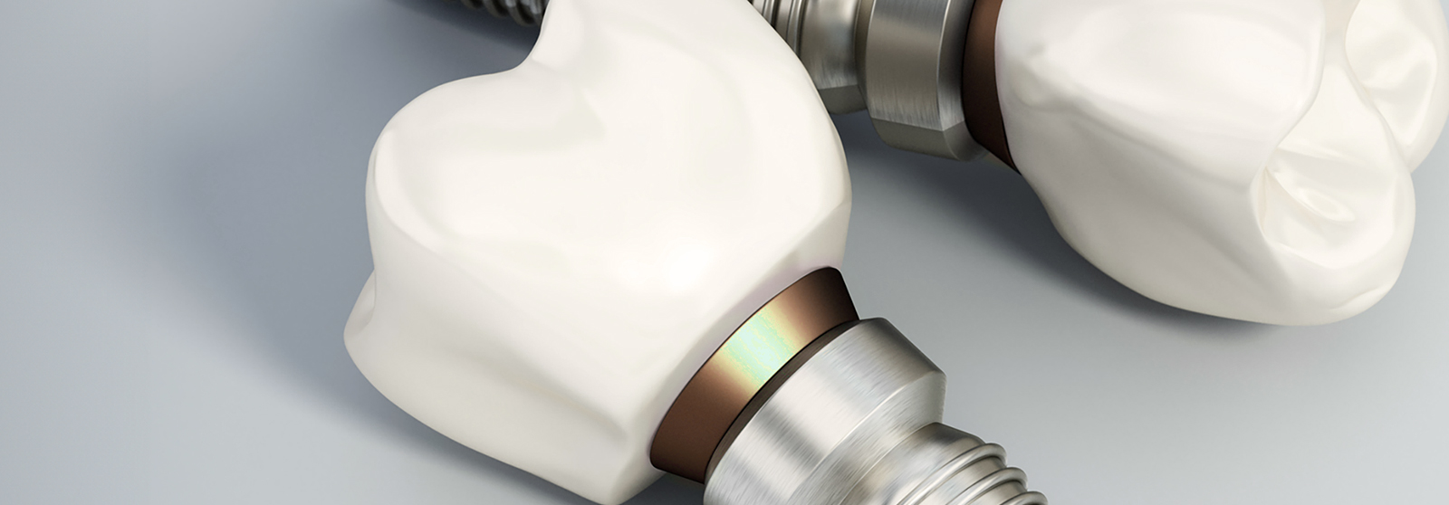 dental implant