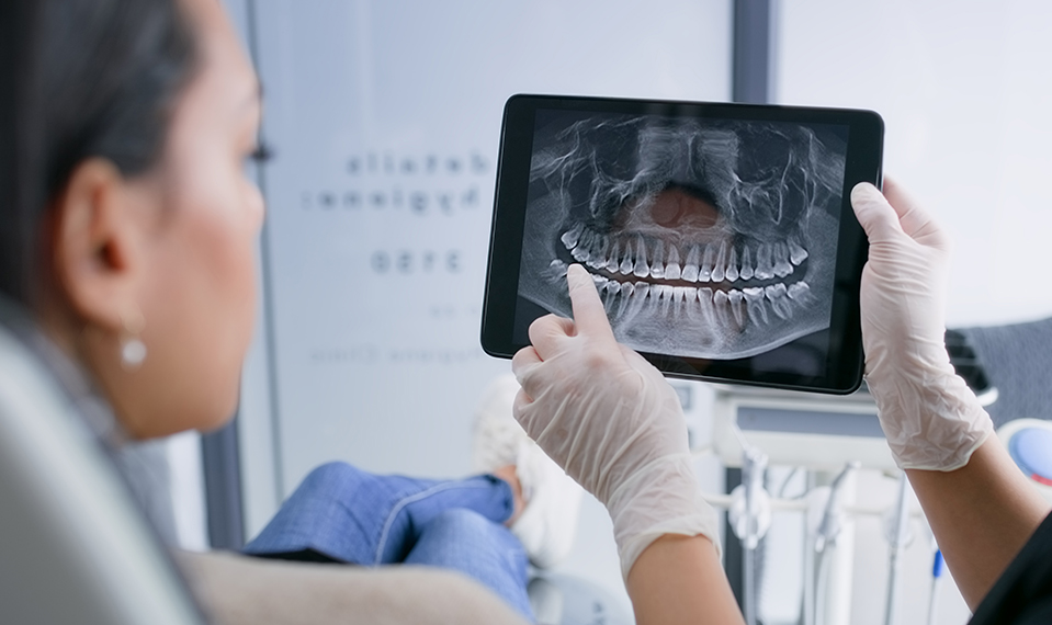 extractions