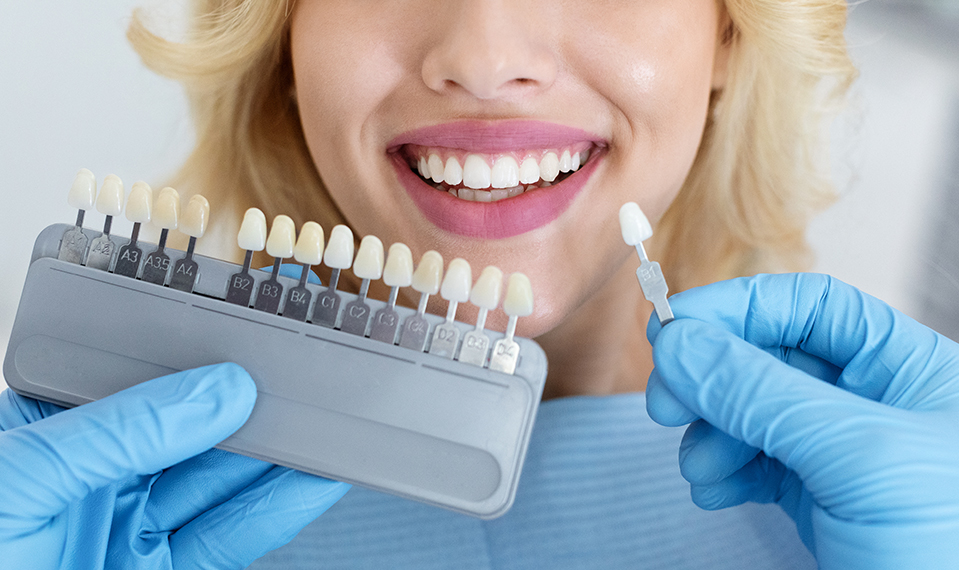 dentist color matching dental implant
