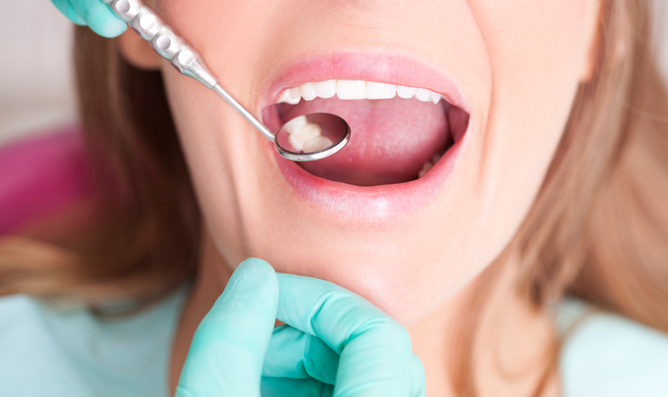 dental check-up